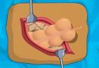 Operate Now: Appendix Surgery